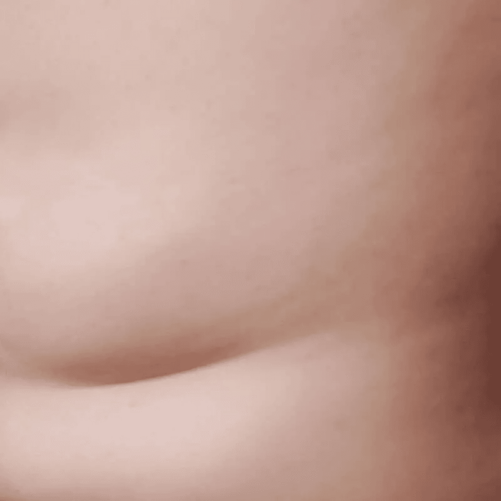 adipe | Istituto di Estetica Paola Dibi Center | Estetica avanzata Montecchio Maggiore dal 1984