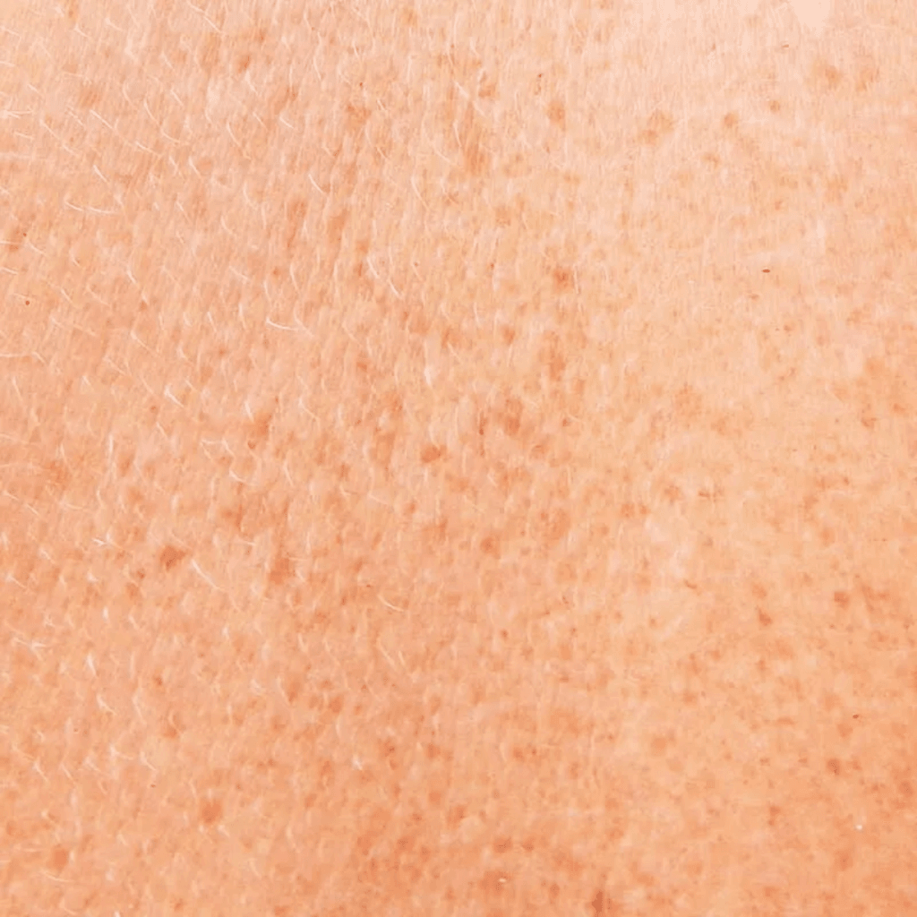 pelle discromie | Istituto di Estetica Paola Dibi Center | Estetica avanzata Montecchio Maggiore dal 1984