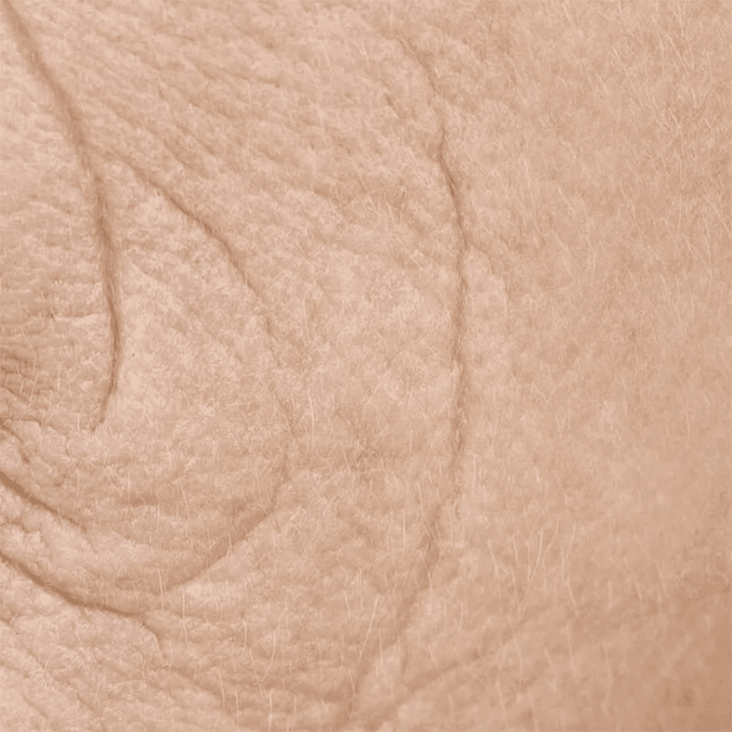 pelle matura rughe | Istituto di Estetica Paola Dibi Center | Estetica avanzata Montecchio Maggiore dal 1984