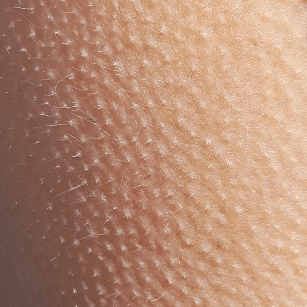 pelle peli superflui | Istituto di Estetica Paola Dibi Center | Estetica avanzata Montecchio Maggiore dal 1984