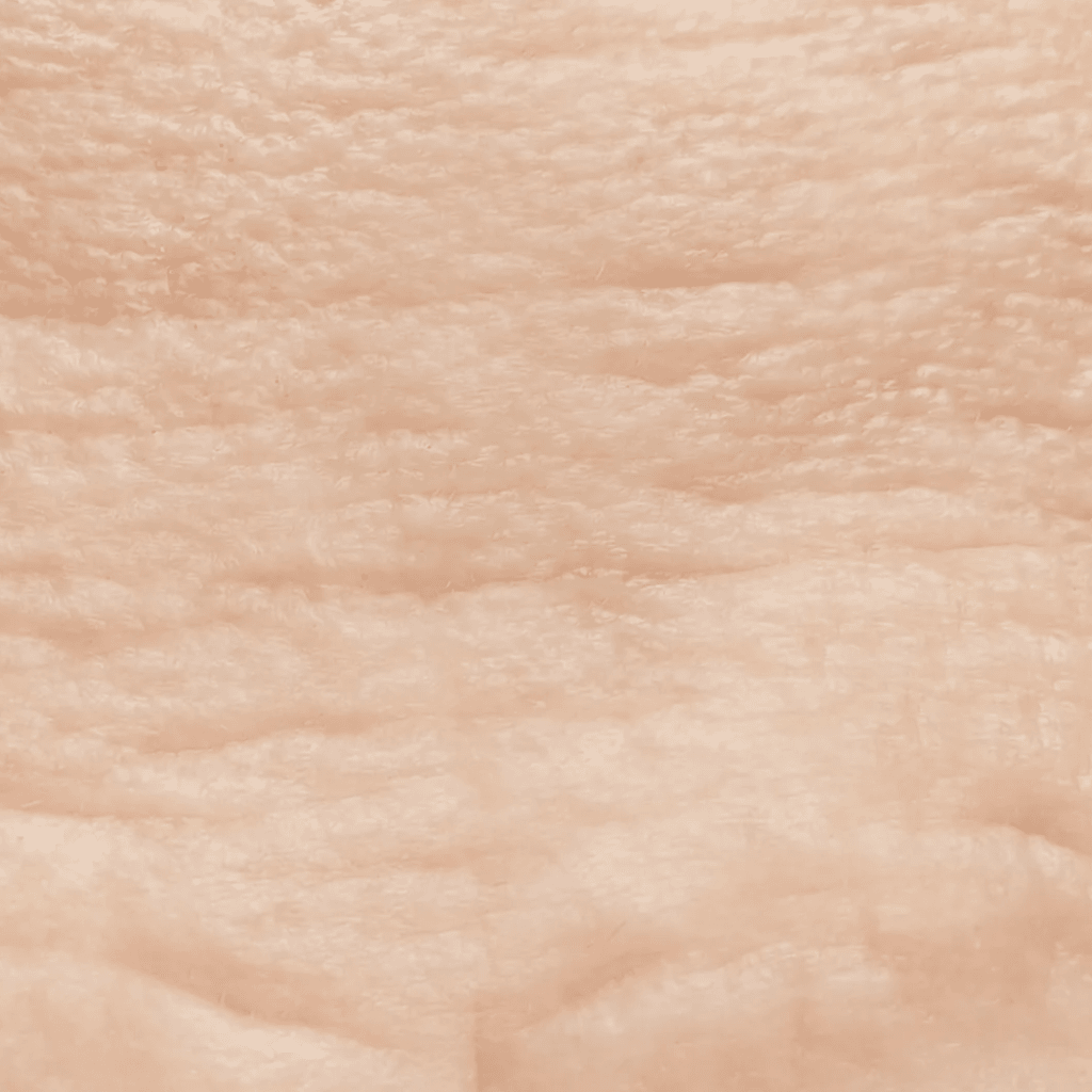 pelle segnata ispessita | Istituto di Estetica Paola Dibi Center | Estetica avanzata Montecchio Maggiore dal 1984