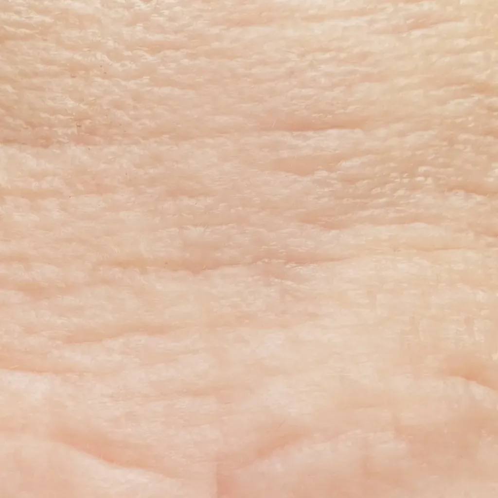 pelle segnata ispessita | Istituto di Estetica Paola Dibi Center | Estetica avanzata Montecchio Maggiore dal 1984