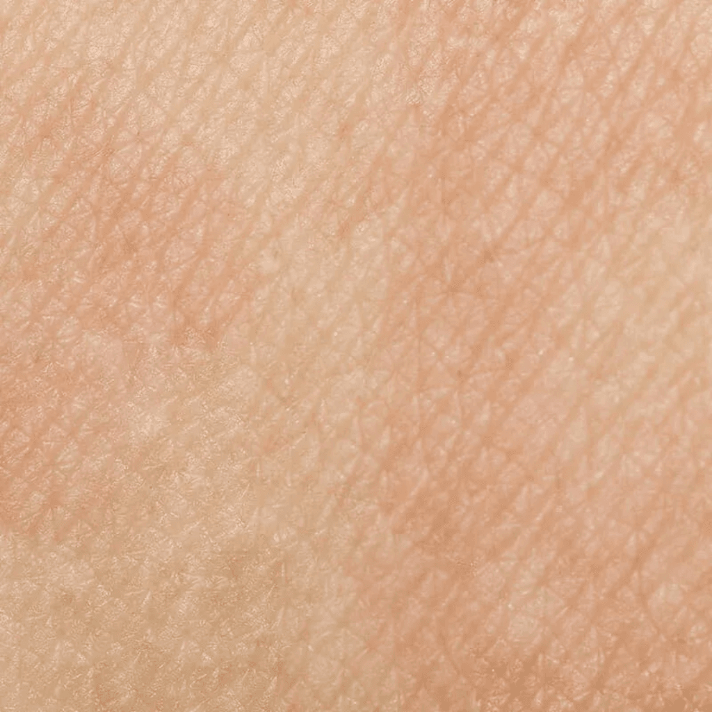 pelle sensibile | Istituto di Estetica Paola Dibi Center | Estetica avanzata Montecchio Maggiore dal 1984