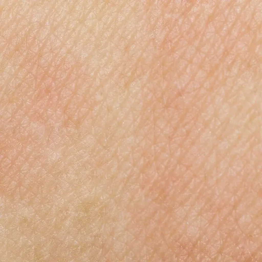 pelle sensibile | Istituto di Estetica Paola Dibi Center | Estetica avanzata Montecchio Maggiore dal 1984